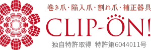 巻き爪の治療「矯正」